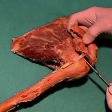 Dissection of The Upper and Lower Limbs