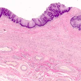 Histology of Vagina