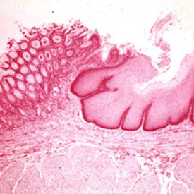 Histology of Rectoanal Junction