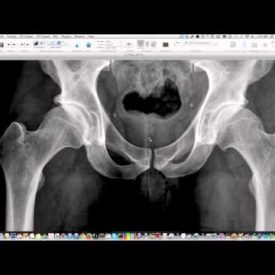 Pelvis And Hips – Essential Radiography