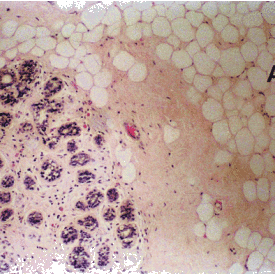 Histology of Inactive Breast