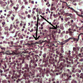 Histology of Liver Reticulin Fibers