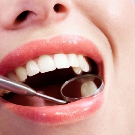 Avoid Cavities