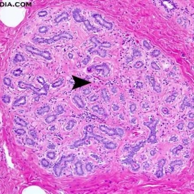 Histology of active breast