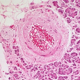 Histology of Large Artery