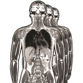 Human body through MRI