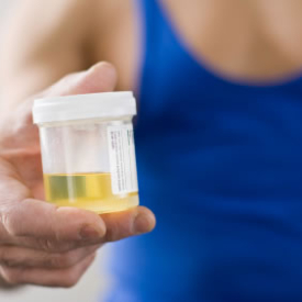 Urine Testing: Protein and Glucose