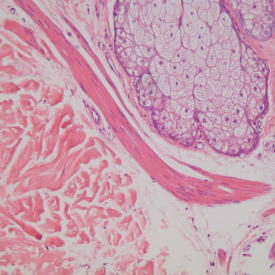 Histology of Fallopian Tube