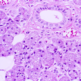 Histology of Parotid Gland
