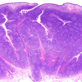 Histology of Palaine Tonsil